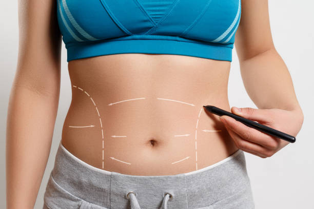 abdominoplasty surgery in cheadle, abdominoplasty-surgery good for me?